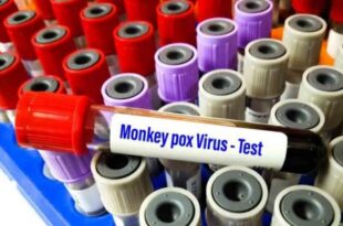 AIims releases SOP on monkey pox