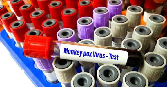 AIims releases SOP on monkey pox