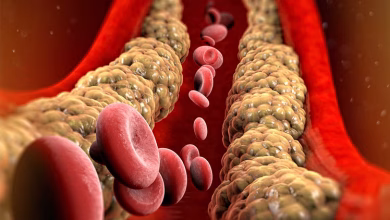 Cholesterol is becoming forgetful: AIIMS reveals