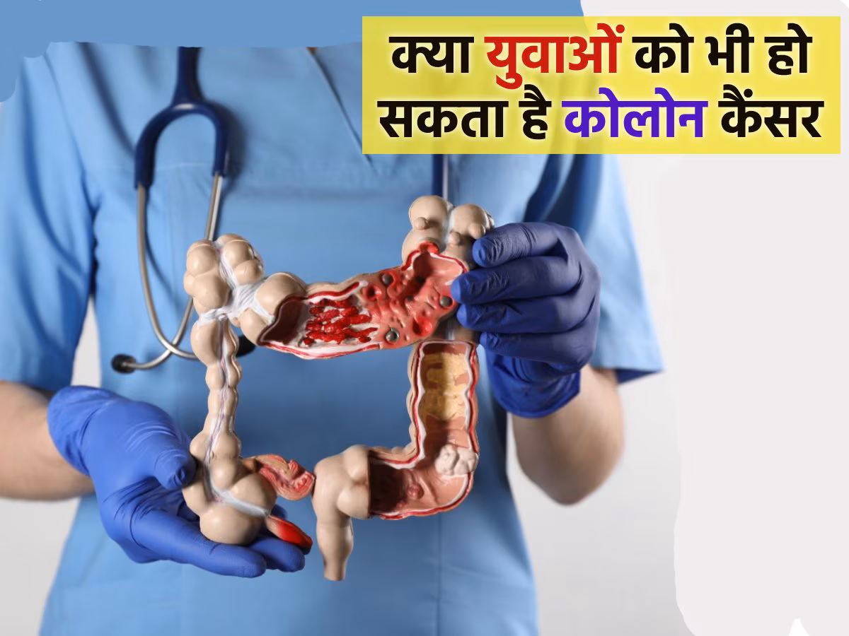 Symptoms of Colon Cancer: Why is the risk increasing among youth?